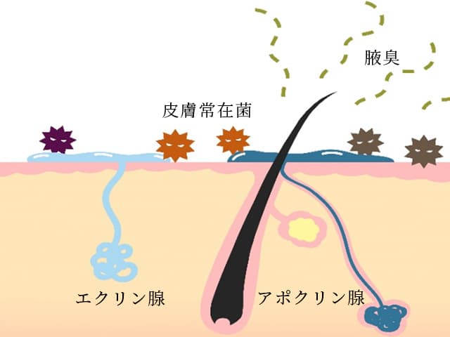 腋臭の原因菌